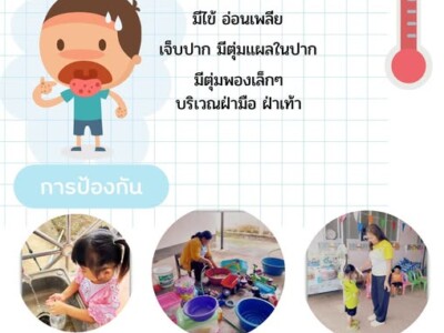 Read more about the article วิธีป้องกันโรคมือเท้าปาก